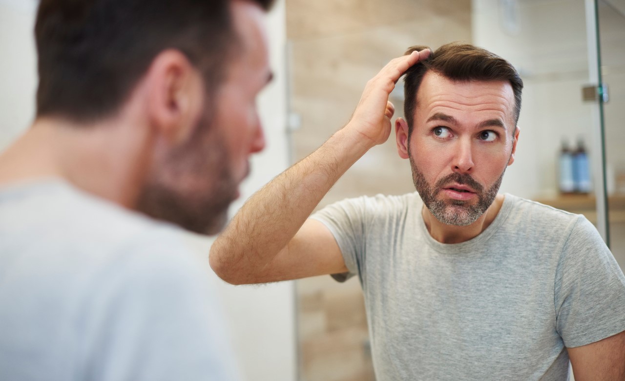 Der Haarausfall Beim Mann Ursachen Behandlung Und Verlauf Haarprodukte Ch
