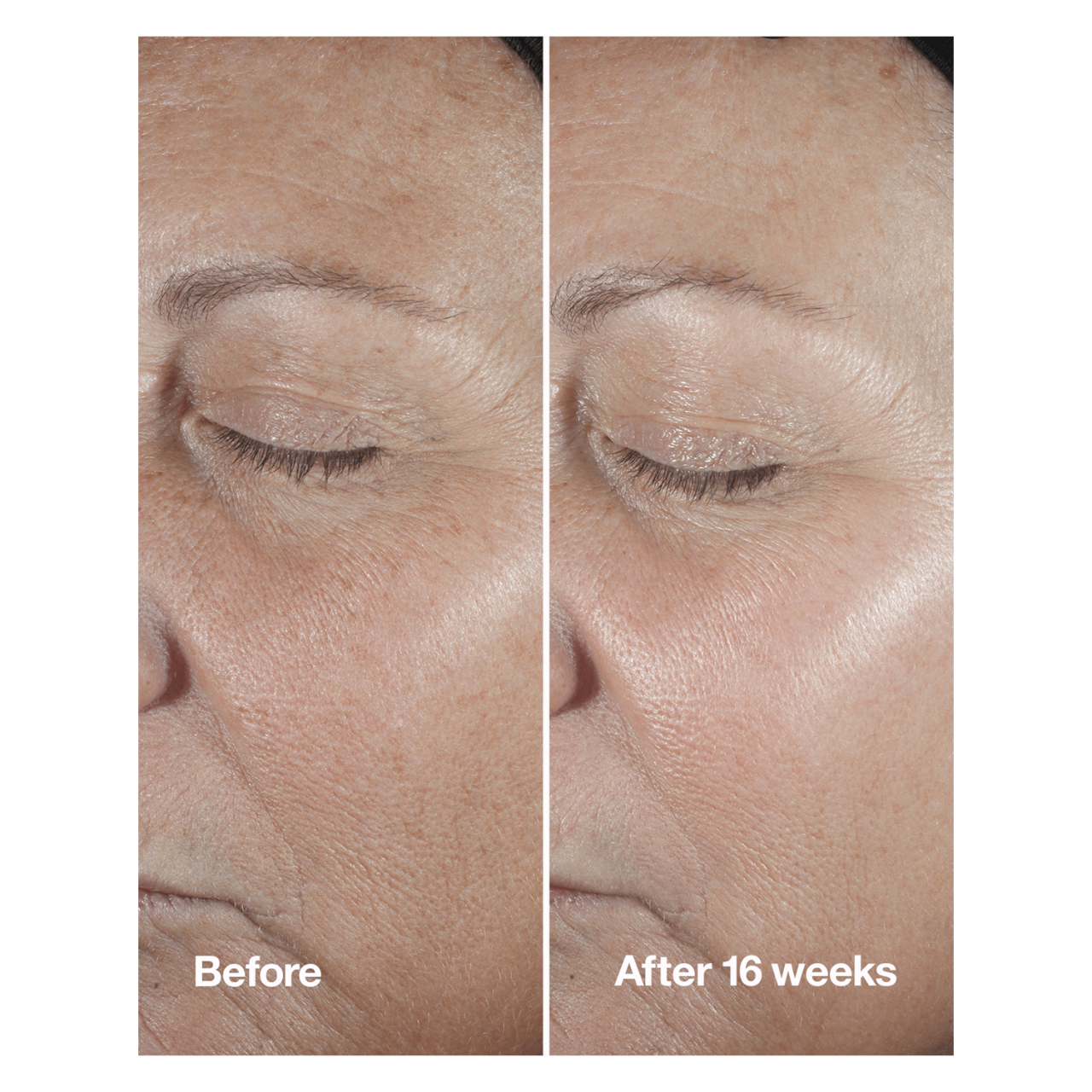 Clinique Smart - Repair Serum